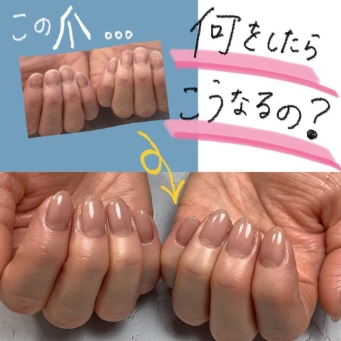 「自爪で美爪になる方法...♥【福井市 / ネイルサロン / メディカルネイルプランナー】」