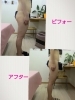 ＊セルライト撃退コースモニター様＊「お正月太りも！セルライト撃退コースでスッキリボディーに大変身♪」