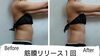 「筋膜剥がしで美姿勢☆」