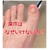 深爪はなぜいけないの？【日本橋三越前駅　徒歩3分　駅近／足の爪切り　ドイツ式フットケア専門店】