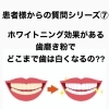 ホワイトニング効果のある歯磨き粉で歯は白くなるの 医療法人同風会 萩原歯科医院のニュース こうのす広場 鴻巣市