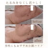 「フェイスラインすっきりで若々しい印象へ【  福井 / エステ / ハイフ / トリプルハイフ / たるみ改善 / むくみ / トーンアップ / 脂肪燃焼 / 小顔  / リフトアップ / 男性  / メンズエステ 】」