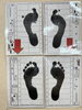 「以外と多い捻挫からの姿勢の歪み、肩こり、腰痛、膝の痛み。貴方は大丈夫ですか？」