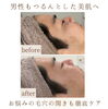 「陶肌ピーリングで毛穴ケア👃🏻✨【 福井 / エステ / ハーブピーリング / 艶 / くすみ除去 / トーンUP / むくみ解消 / リフトアップ / 毛穴 / ニキビ / ニキビ跡 / シミ 】」