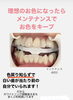 メディカルホワイトニング「メンテナンス」