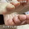「コンプレックスだった小指が・・・」