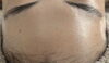 「エレクトロポレーションで艶々✨【 福井 / エステ / ポレーション / ハリ / 艶 / 美容液導入  】」