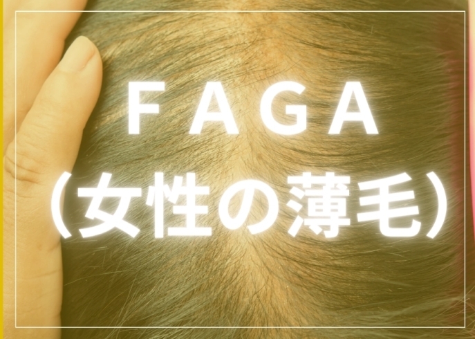 女性の薄毛「FAGA（女性の薄毛）でお悩みの方へ、当店の薄毛・抜け毛ケアをご紹介！」