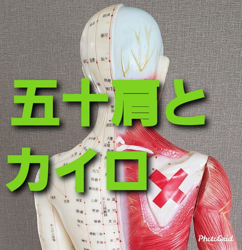 続・五十肩とカイロ「続・五十肩とカイロ」