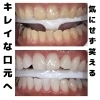 メディカルホワイトニング「お客様ご紹介」