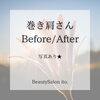 「巻き肩さんBefore/After」