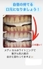 メディカルホワイトニング「メディカルホワイトニング」