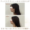 「正面だけじゃない横顔まで美人に🥰💗  ̖́-‬【 福井 / 福井エステ / 福井ハイフ / トリプルハイフ / 小顔 / リフトアップ / キャンペーン中  】」