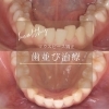 歯並び、綺麗にしませんか？　#千歳 #恵庭 #苫小牧 #歯医者 #歯並び #矯正 #マウスピース矯正 #綺麗になりたい #白い歯 #ホワイトニング 