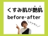 次の画像へ→✨「40代　くすみ肌から艶肌に✨✨」