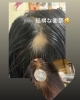 「♡頭皮♡頭髪♡健やかに♡生えてきました♡」