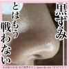 黒ずみとの戦いはもう終わり【大分市/大在/毛穴専門エステサロン/pore do vivi（ﾎﾟﾚﾄﾞﾋﾞﾋﾞ）】