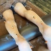 身体の冷えやだるさには鍼灸が1番！