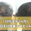 【30代男性】薄毛と大量のフケが3ヵ月スピード改善症例