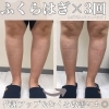 「ひざ下をピンポイントで引き締め◎那須塩原で部分痩せが得意なエステサロン プメハナ！」