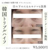 若々しい目元に戻りませんか？「目の下のたるみやクマも改善できる🫣❣️【福井ハイフ/福井エステ/福井フェイシャル/福井ハーブ】」