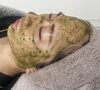 スタッフも全員大好きで毎月しています💆‍♀️「強力ハーブで年内に肌荒れを一掃しませんか？【福井ハーブピーリング/福井ハーブ/福井フェイシャルエステ/福井美肌】」