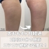 「諦めていた太ももが細くなりました◎脂肪燃焼＆筋肉増加痩身マシンで美脚に◎」