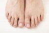 足爪「足の爪が痛くて、赤い肉が膨れてきた！形成外科でご相談を」