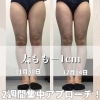 「2週間で太もも−1cmの痩身マシンで足痩せ◎」