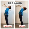 一回の施術でもこれだけ変わります！「腰痛改善に必要なこと【宮崎市で肩こり・腰痛改善の整骨院】」