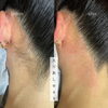 「waxでベリッと一瞬脱毛！」