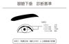 眼瞼下垂の診断基準「眼瞼下垂症手術前後の変化ー形成外科専門医との対話」