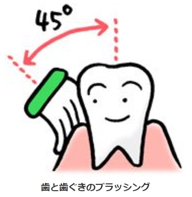 歯と歯ぐきのプラッシング    高蔵寺フェアリ歯科「健康維持の答えは『歯の健康』にあり、毎日のブラッシングと定期的な歯科医受診で歯石除去です。」