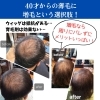 美容室の増毛！リピート増えてます。「40才からの薄毛に！美容室でカットついでに出来る増毛体験！【宮崎市・フェイシャルエステ・肌診断・増毛・シミ取り・エイジングケア・目元ケア・ヘッドマッサージ・ハーブピーリング・卒業式入学式着付け】」