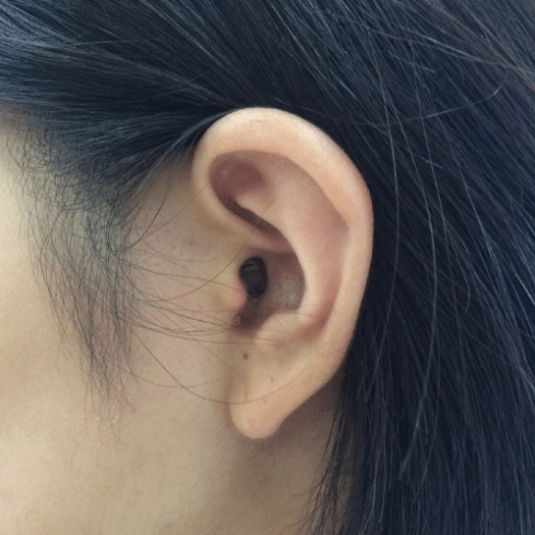 「【ブログ更新】スターキーとフォナック　2社がオトスキャン（耳型3Dスキャン）に対応　超小型IIC補聴器を4社まとめて比較　言語聴覚士/認定技能者の補聴器専門店」