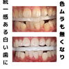 メディカルホワイトニング「お客さまご紹介」