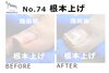「巻き爪のおすすめのケア「根本上げ」」