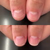 親指「深爪でお悩みの方【札幌市南区川沿 自爪育成サロン nailsalon Rubino】」