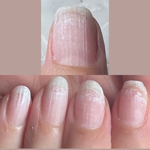 乾燥で爪が白く傷んだ爪も改善できる！「爪質改善（形・乾燥・噛み癖・小さい爪）サロン🌺三郷市ネイルサロン🌺」