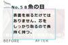 No.58たこ・魚の目の施術事例１「No.58芯までとるたこ・魚の目の施術事例」