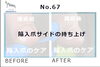 N67.陥入爪サイドの持ち上げ施術事例１「N67.陥入爪サイドの持ち上げ施術事例」