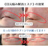 最新美容成分で、シワ撃退！「大好評です♥️1回でシワが浅くなるエステ！【宮崎市エステ・リセル・目元悩み・ほうれい線・小顔・エクソソーム・頭皮マッサージ・NMN】」