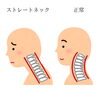「しんどいストレートネック」