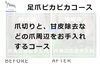 No.55爪切りの施術事例１「No.55爪切りの施術事例」