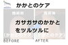 No.53かかとケアの施術事例１「No.53かかとケアの施術事例」