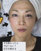 サーモシェイプ3分「中国地方初！サーモシェイプと美容鍼！」