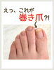 かくれ巻き爪さん⁈「【巻き爪】気づいてないだけかも⁈」