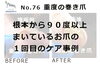 No.76　重度の巻き爪のケア１回目１「No.76　重度の巻き爪のケア１回目」