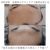 「美肌は身だしなみの1つに☝！【 福井 / 福井エステ / 福井メンズエステ / 福井ハーブピーリング / 美肌管理 / 肌質改善 / にきび / 角質除去 / くすみ / 毛穴 / ハリ / ツヤ肌  】」