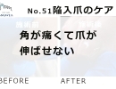 No.51陥入爪「角が痛くて爪が伸ばせない」